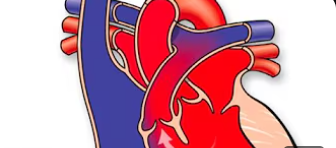 শেষ পর্যন্ত সুস্থ হয়েই বাড়ি গেল ছোট্ট মাশকুরা